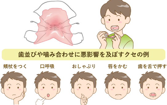 なぜ早期相談が大切か